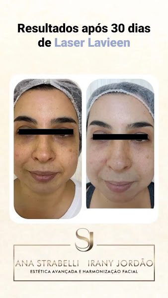 Foto 2 de Estética Saúde e Beleza