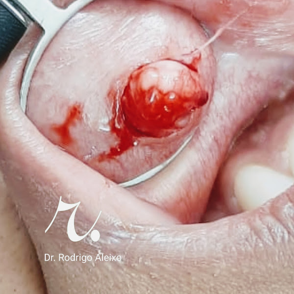 Foto 3 de Estomatologia - Dr. Rodrigo Aleixo