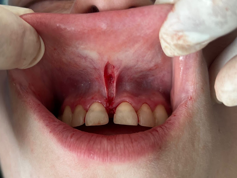 Foto de Estomatologia e Cirurgia Bucomaxilofacial & Laserterapia Terapeutica - Julio Cesar Bisinelli