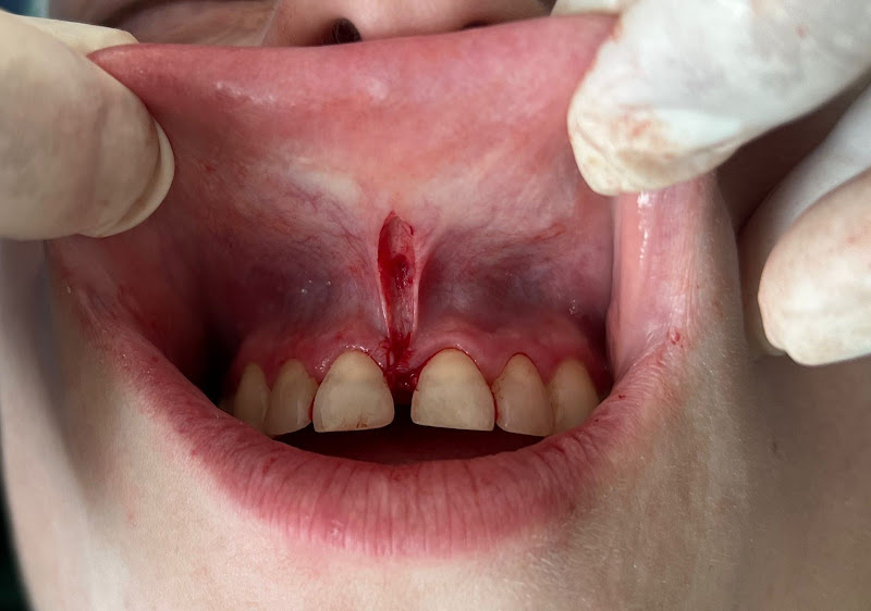 Foto 2 de Estomatologia e Cirurgia Bucomaxilofacial & Laserterapia Terapeutica - Julio Cesar Bisinelli