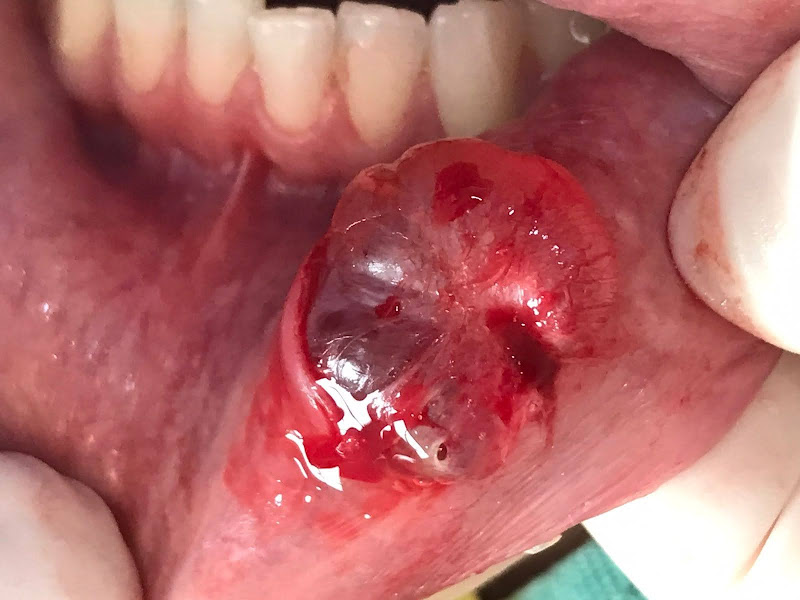 Foto 3 de Estomatologia e Cirurgia Bucomaxilofacial & Laserterapia Terapeutica - Julio Cesar Bisinelli