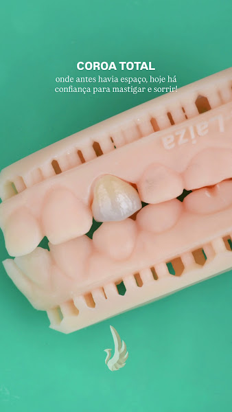 Foto 4 de Evident Clínicas Odontológicas - Mogi das Cruzes - Dentistas - Implantes - Invisalign Doctor - Lentes de Porcela