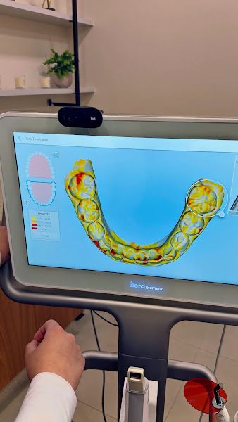 Foto 5 de Evident Clínicas Odontológicas - Mogi das Cruzes - Dentistas - Implantes - Invisalign Doctor - Lentes de Porcela