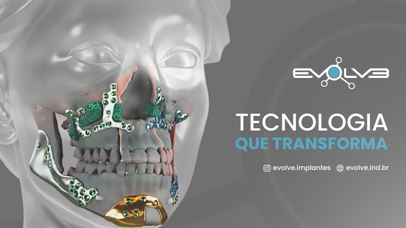 Foto de Evolve Implantes | Fábrica de Implantes Personalizados