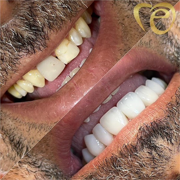 Foto 2 de Excellencce Odonto | Dental Clinic