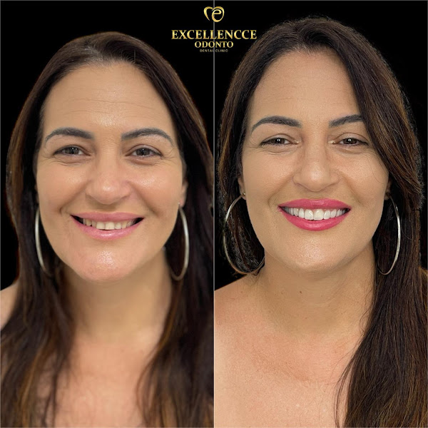 Foto 3 de Excellencce Odonto | Dental Clinic