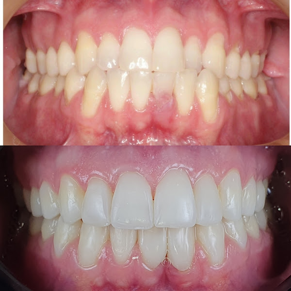 Foto 2 de Exclusivité Odontologia Especializada