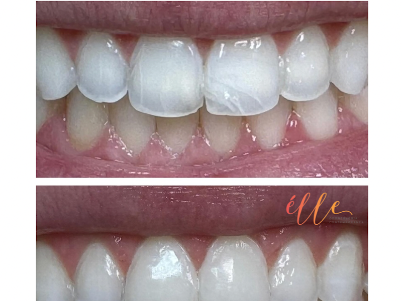 Foto 8 de Exemple Odontologia