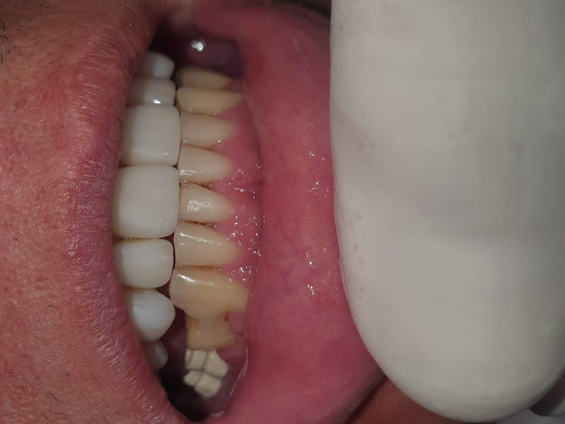 Foto 6 de Exp Odontologia | Consultório Odontológico