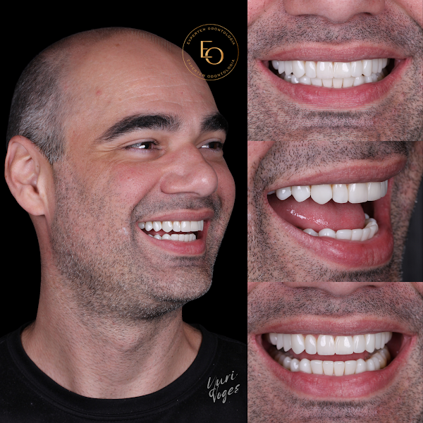 Foto 2 de Experten Clínica Odontológica