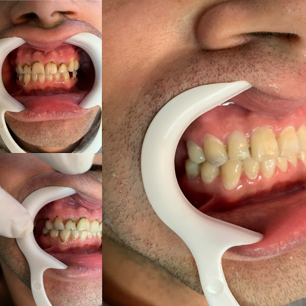 Foto 3 de Expodonto Odontologia