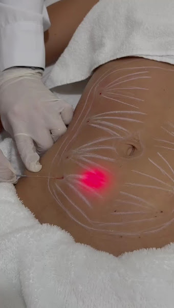 Foto 3 de Fabiane Jatoba Harmonização Facial e Corporal - Parauapebas