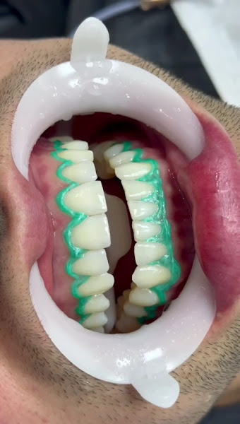 Foto 4 de Fabio Busnello Odontologia - Consultório odontológico em Ponta Grossa