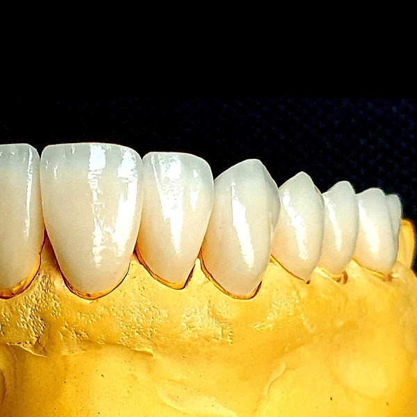 Foto 3 de Fábio Micrute - Odontologia Especializada