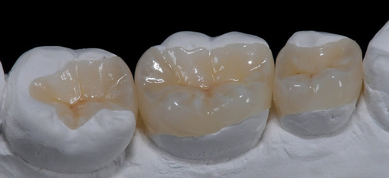 Foto 3 de Fabio Turco Odontologia - IOFT