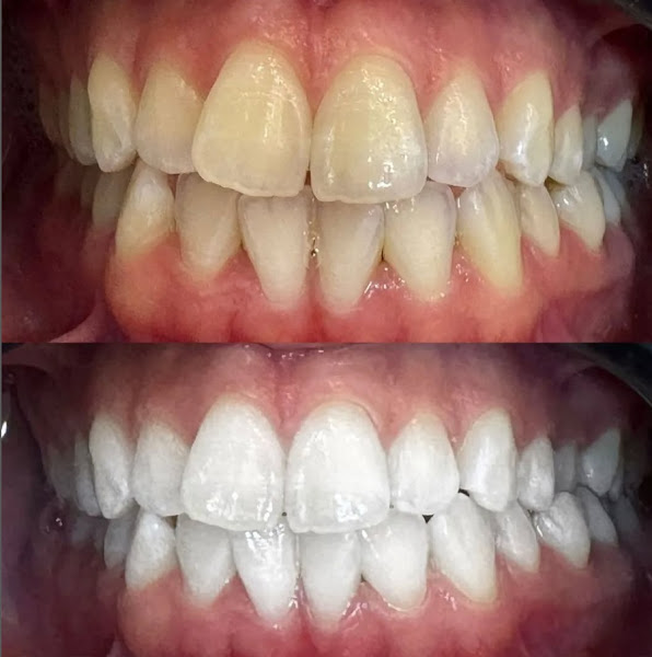 Foto 3 de Face Dente - Odontologia e Estética