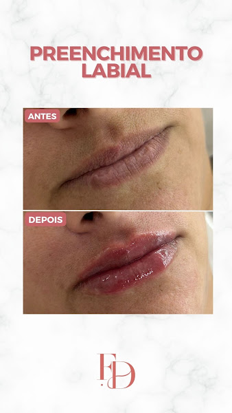 Foto 2 de FACE DOCTOR TOLEDO | Harmonização Facial e Corporal