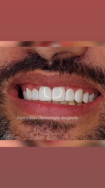 Foto 2 de Face e Riso Odontologia Integrada