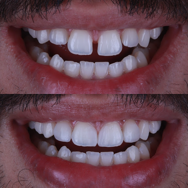 Foto 2 de Face Machine