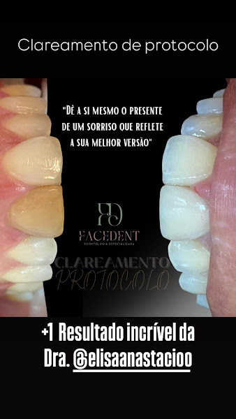 Foto 3 de Facedent Odontologia Especializada - Olinda