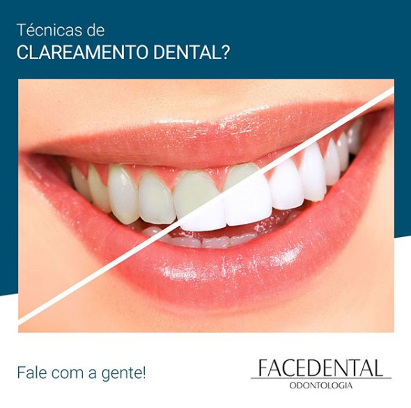 Foto 3 de Facedental