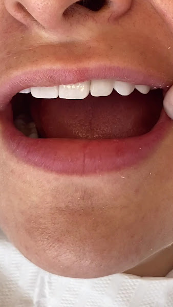 Foto 4 de Faces Odontologia Especializada - Lentes de Contato Dental