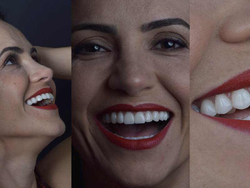 Foto 8 de Faces Odontologia Especializada - Lentes de Contato Dental