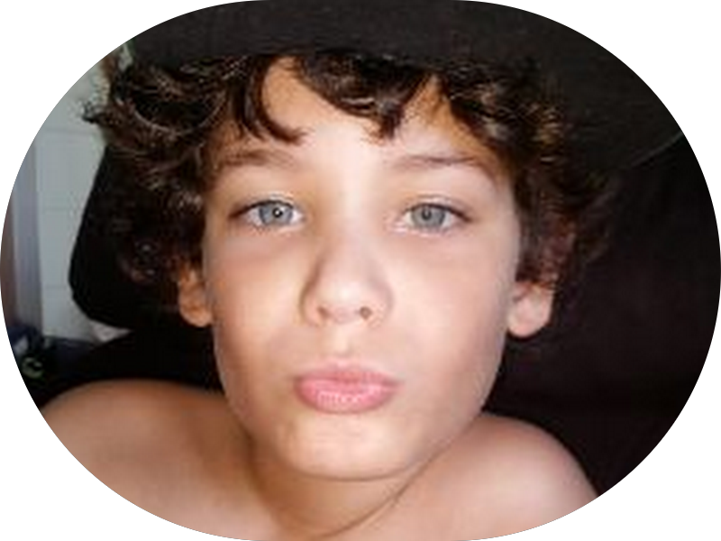 Foto 6 de FACETAS EM RESINA E IMPLANTES DENTÁRIOS EM FLORIANÓPOLIS DRA. FERNANDA FERNANDES