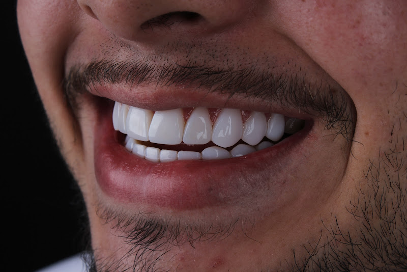 Foto 2 de Facetas ZN