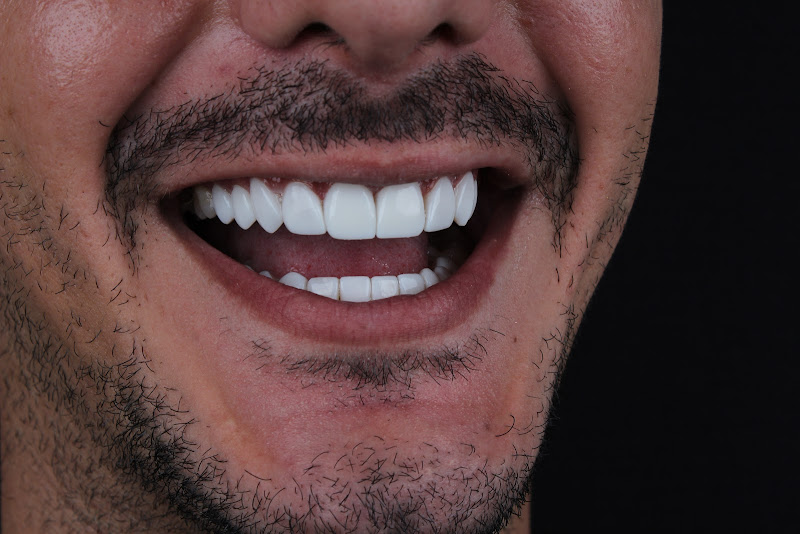 Foto 3 de Facetas ZN