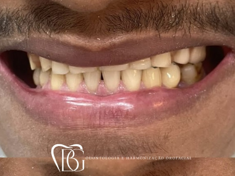 Foto 10 de Facia Odontologia