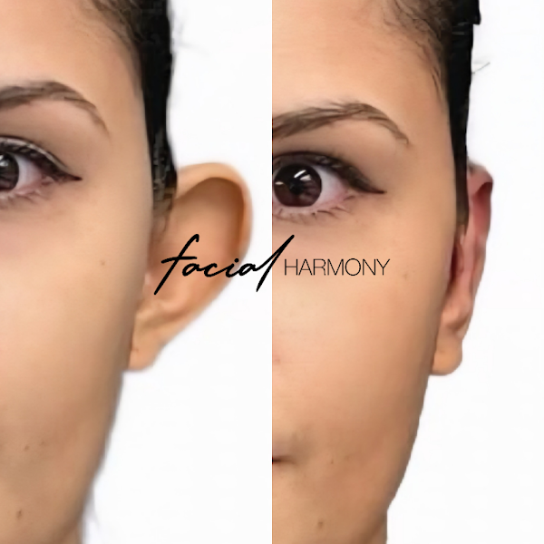 Foto 2 de Facial Harmony Saúde e Estética Avançada | Dra. Caroline Marinho