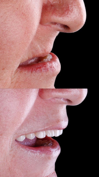 Foto 2 de FacialClin - Clínica Odontológica em Vitória de Santo Antão