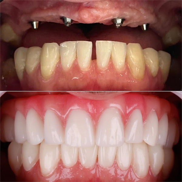 Foto 3 de FacialClin - Clínica Odontológica em Vitória de Santo Antão