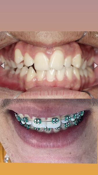 Foto de Fácil Sorriso