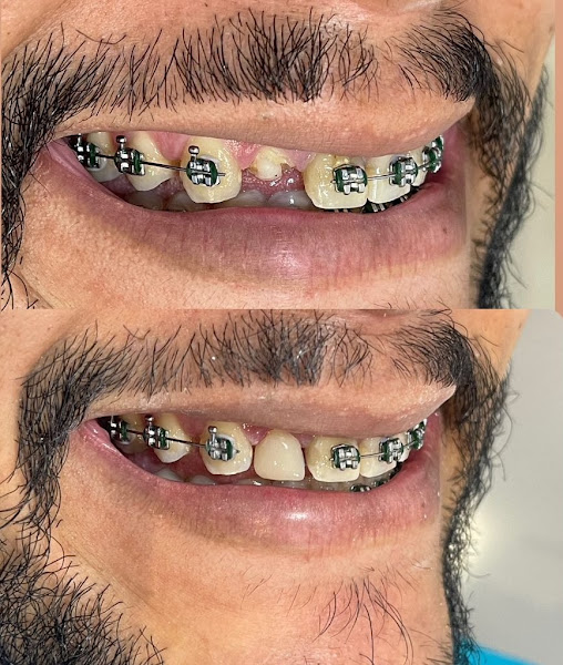 Foto 2 de Fácil Sorriso