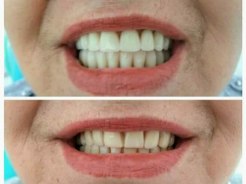 Foto 5 de FACÍLIMA ODONTOLOGIA