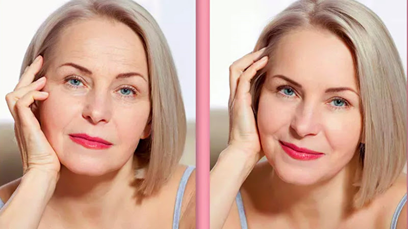 Foto 5 de Fantin Odonto - Dentista Zona Norte SP | Dentista Santana | Facetas | Lentes de Contato | Implantes | Odontopediatra