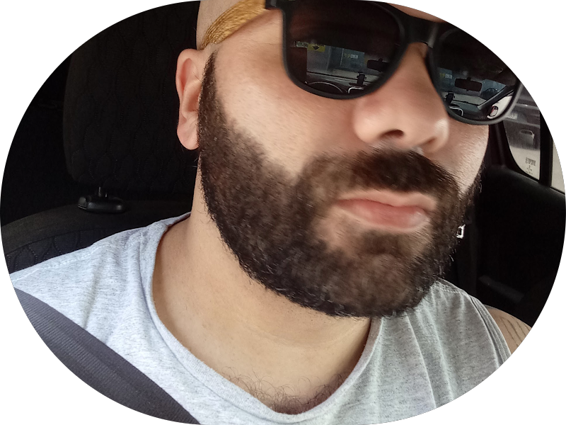 Foto 6 de Fantin Odonto - Dentista Zona Norte SP | Dentista Santana | Facetas | Lentes de Contato | Implantes | Odontopediatra