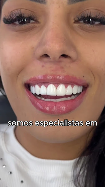Foto 3 de Fast Sorriso BH Clínica Odontológica, Referência Lentes de Resina/Porcelana, Dentista Vila da Serra - Nova Lima