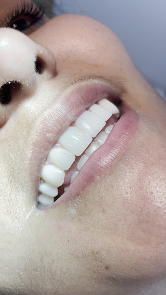 Foto 3 de Fast Sorriso