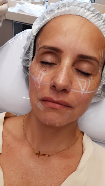 Foto 3 de Fátima Bricks - Odontologia Integrada e Harmonização Facial