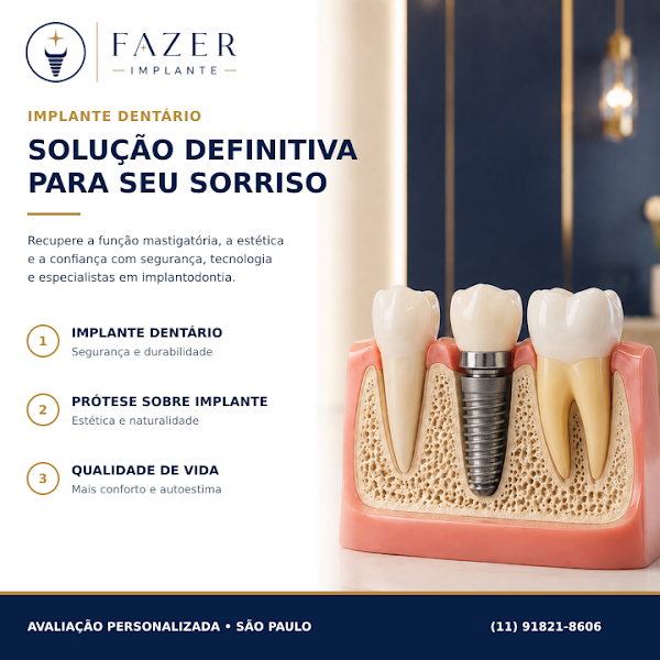 Foto 2 de Fazer Implante | Dentista em São Paulo