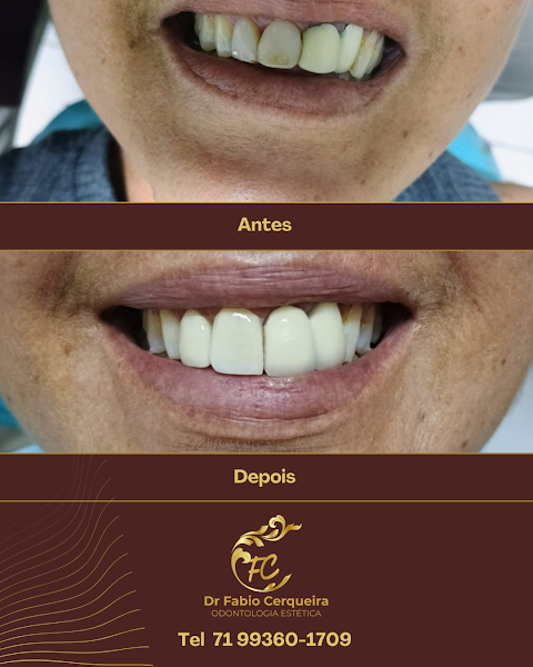 Foto 3 de FC Odontologia e Estética