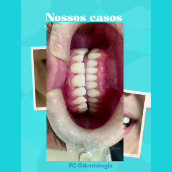 Foto 3 de FC ODONTOLOGIA | VILA MATILDE