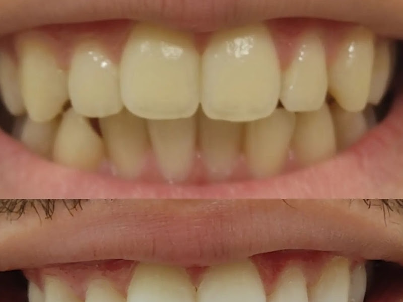 Foto 11 de FCOdontologia - Fernando Carvalho Odontologia