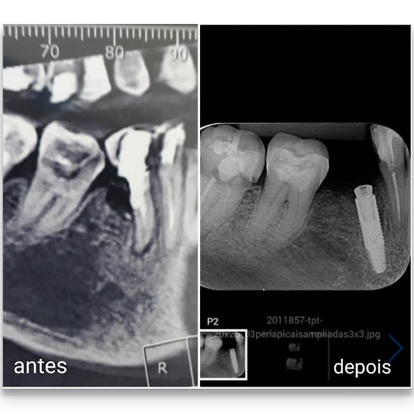 Foto 3 de Fernandes Madeira Odontologia