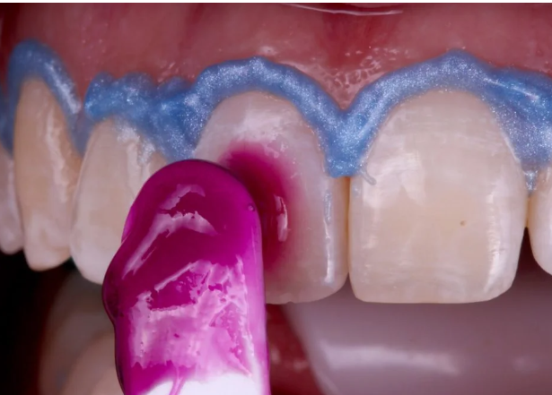 Foto 3 de Fernandes Odontologia - Dentista na Vila Guilherme