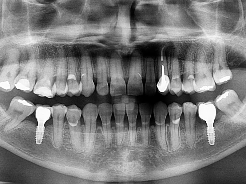 Foto 2 de Fernando Almeida Prótese Dentária