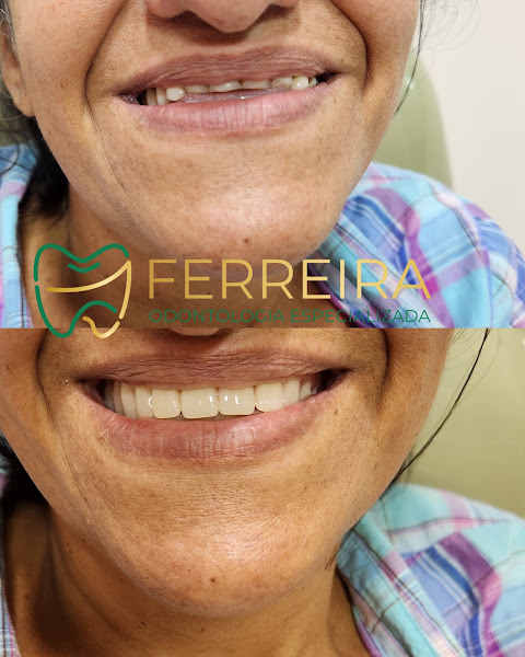 Foto 2 de Ferreira Odontologia Especializada